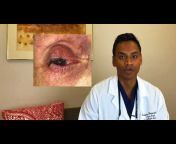 Thiagarajah Chris MD - Denver Oculoplastic Surgeon