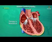 Dr.G Bhanu Prakash Animated Medical Videos