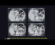 Radiology Video - radiology made esay