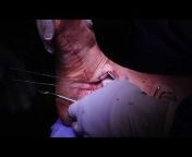 Foot and Ankle Surgery Academy