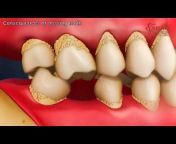 Dental Solutions Clinic Bangalore