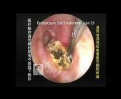 Dr. Zhao Video