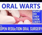 The OPEN REDUcTION Oral Surgery w/Dr. Tom Bolten