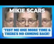 Mikey Scars