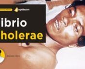 Learn all about Vibrio Cholerae in this online Infectious Medicine lecture. This V-Learning™ highlights the epidemiology and Pathogenesis of Cholerae along with vibrio cholerae caracteristicas i.e. clinical features a patient represents. The discussion continues on diagnosis as well as treatment. Noncholera vibriosis is also explained in this lecture.nn-------------------------------------------------------------nWatch complete lecture on sqadia.com:nhttps://www.sqadia.com/programs/vibrio-chol