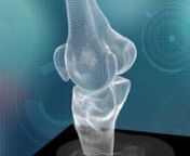 ConforMIS iFit® Image-to-Implant Technology Platform from ifit