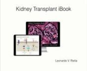 Transplantation is one of the most exciting fields in medicine. However, learning about kidney transplant has become much harder for those initiating in the field due to the dramatic expansion of knowledge in the past decade. The Kidney Transplant iBook is an interactive book that employs different learning tools in attempt to keep learning fun, interactive and efficient. nnThe image collection is vast, reflecting more than 7 years of work. There are more than 250 original figures, which include