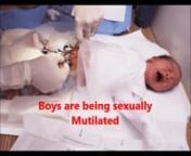 Over the years I knew circumcision was wrong as a routine. In 1990 I became a active anti-circumcision advocate, but the backlash and denial were too great. The effort stopped out of frustration Still I knew I was right now in 2019 we are seeing this agenda spreading to open minded people in the US. Routine circumcision is not practised in other countries except of course Islamic or Jewish cultures and as a cruel Tuli right in theAfrica and some south Asian cultures.