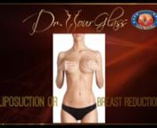 Hi, this is Dr. Hourglass, and welcome to another video in our channel Wonder Breasts. Today we are going to discuss: Liposuction or breast reduction?In this channel we discuss everything related to breast surgery.nnWelcome back!While many patients are looking for breast augmentation procedures, there are plenty who are interested in reducing the size of their breasts.nOverly large breasts can be an issue for many women as it puts a lot of pressure on the spine, hence affecting their overa
