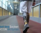 Learn more about the ICON™ BK at MartinBionics.com or call 844.MBIONIC (844.624.6642).nnTalk to a Socket-less Socket™ expert here: https://bit.ly/2SHrX4C