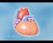 Anatomy of a Heart Attack - Animation from heart anatomy
