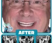 SOTA Dental - Before & After wCT Scan from sota