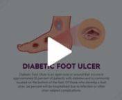 Diabetic Foot Ulcer Animated Presentation - SketchBubble from diabetic ulcer presentation