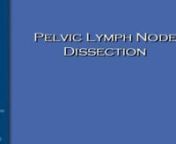 Dr Stephan Ariyan - LYMPH NODE DISSECTION- PELVIC NODES- 11min- 2008 from ariyan