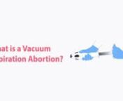 One of the safest abortion methods is the vacuum aspiration abortion. On this video, you&#39;ll learn what is a vacuum aspiration abortion, the differences between the manual vacuum aspiration abortion and the electric vacuum aspiration abortion, in addition to what to expect before, during and after this type of abortion method.nnIf you want to learn even more on safe abortions, visit: https://safe2choose.org/