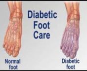 Diabetic Foot Care - Foot Specialist, Foot Doctor and Podiatrist, Toronto, ONn Chiropodist Marz Hardy discusses the symptoms, causes and treatments for Diabetic Foot Problemsnhttp://www.academyclinics.comnDiabetes and Your FeetnAccording to the American Diabetes Association, about 15.7 million people (5.9 percent of the United States population) have diabetes. Nervous system damage (also called neuropathy) affects about 60 to 70 percent of people with diabetes and is a major complication that ma