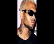 Chris Brown has been accused of badly injuring a 24-year-old girl inside an Orange County nightclub Saturday night ... and the alleged victim says it was so violent she might need surgery.