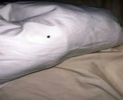 Mum horrified after finding bed bugs in Blackpool guest house from son bed