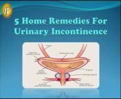 #uti #urinaryincontinence #homeremedies&#60;br/&#62;Urinary incontinence is the involuntary leakage of urine; in simple terms, to wee when you don&#39;t intend to. It is the inability to hold urine in the bladder because voluntary control over the urinary sphincter is either lost or weakened. So, here we have 5 home remedies for Urinary Incontinence.&#60;br/&#62;&#60;br/&#62;You can also view our other informative videos based on home, natural, herbal remedies for all health problems, human internal body problems, causes, symptoms &amp; along with their most easiest and highly effective solutions.